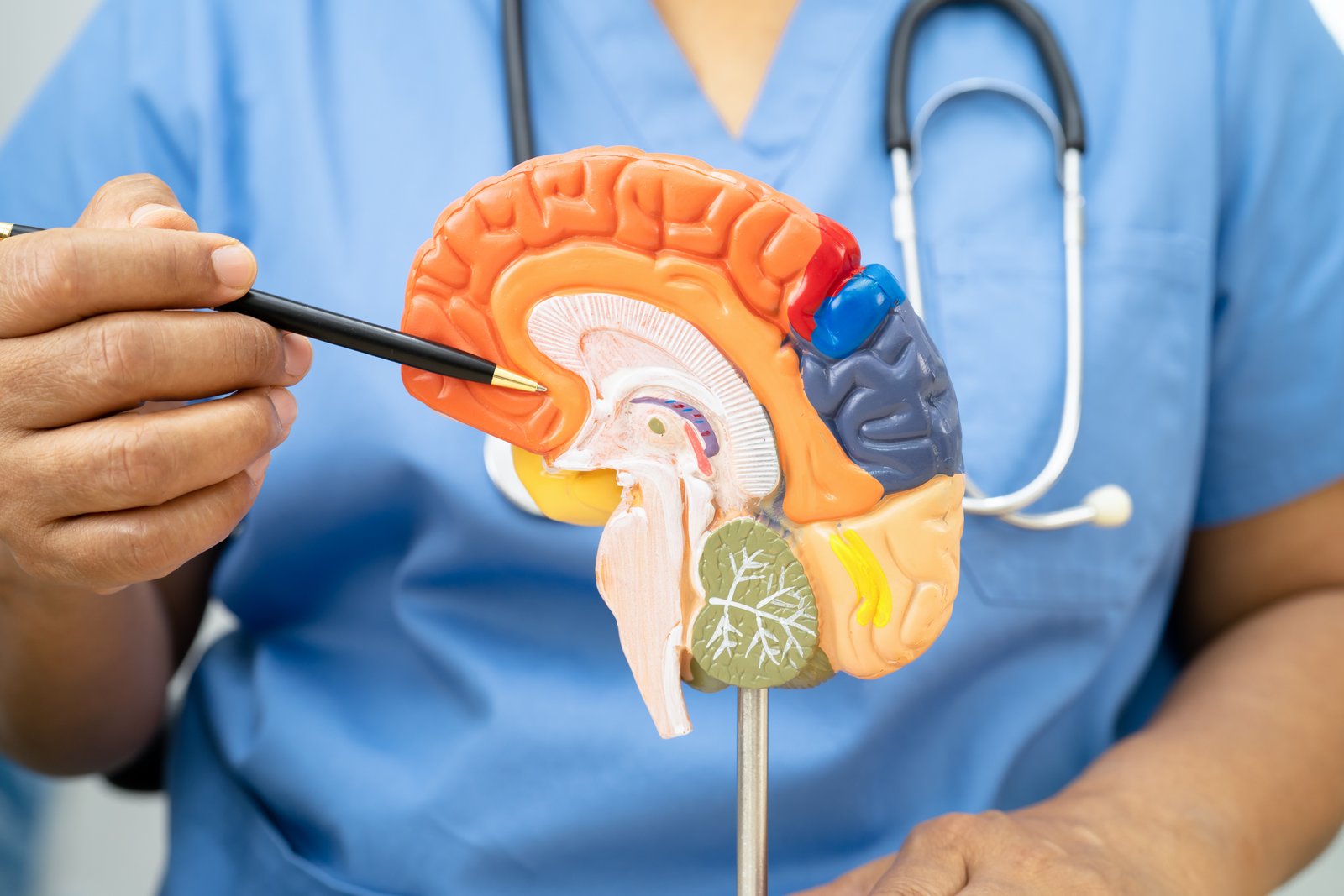 Image du quiz L’AVC : Signes, causes, prise en charge